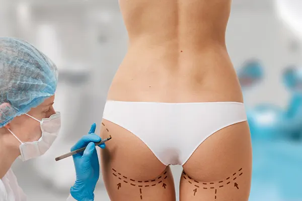 Hilos Tensores Gluteos